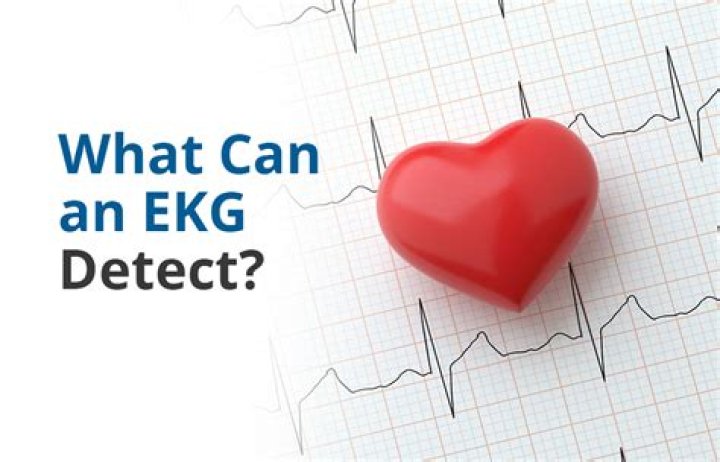 Can an EKG detect sudden cardiac arrest?