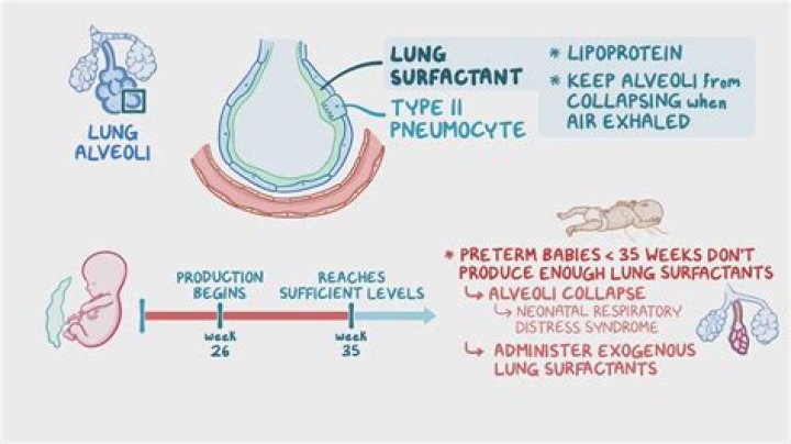 Can oligohydramnios cause preterm labor?