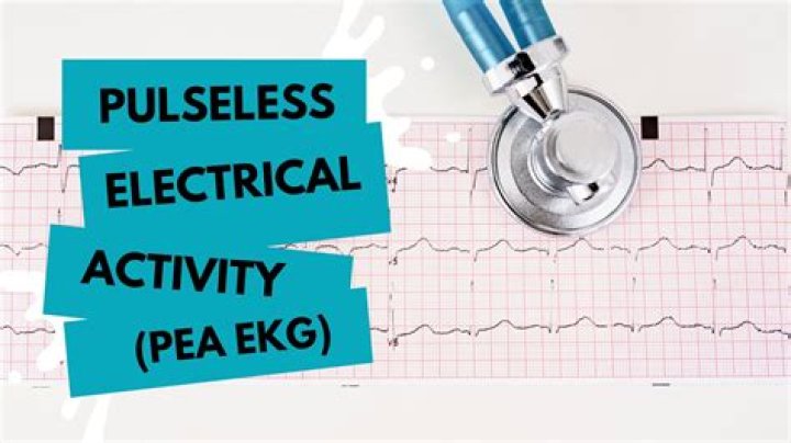 How can you tell a PEA on an ECG?