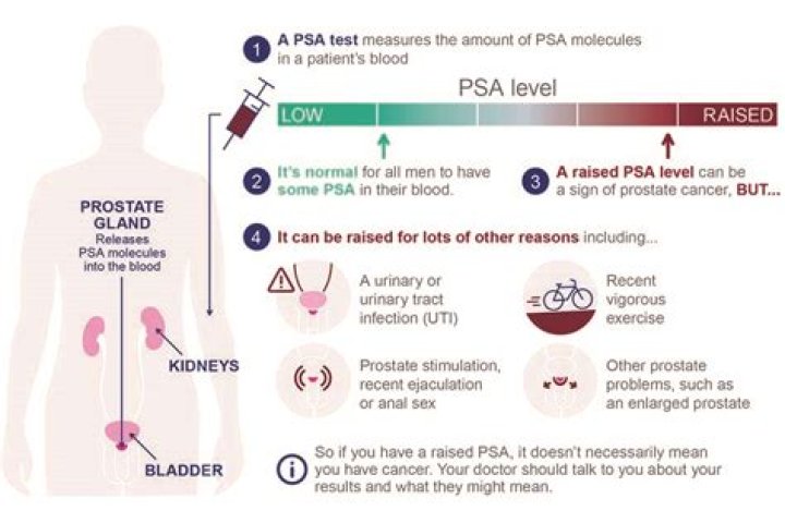 How fast does PSA rise with prostate cancer?