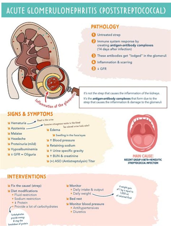 How is rapidly progressive glomerulonephritis treated?