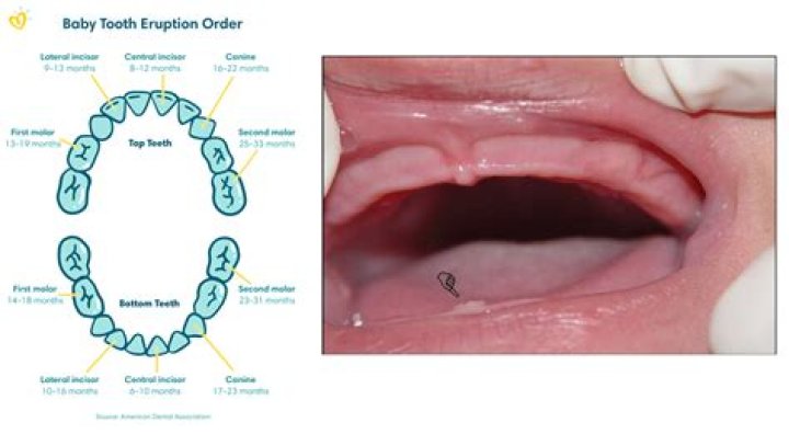 How long can a baby tooth last in adults?