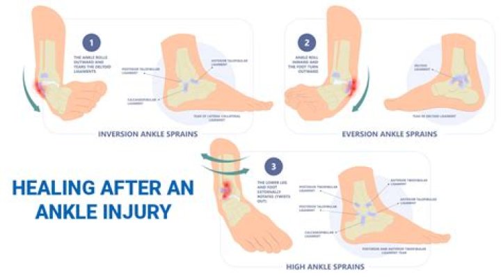 How long does a bruised heel take to heal?