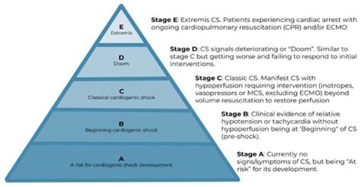 What are the 4 stopping points in order?