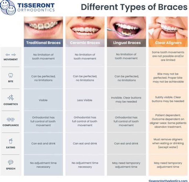 What do braces mean in regex?