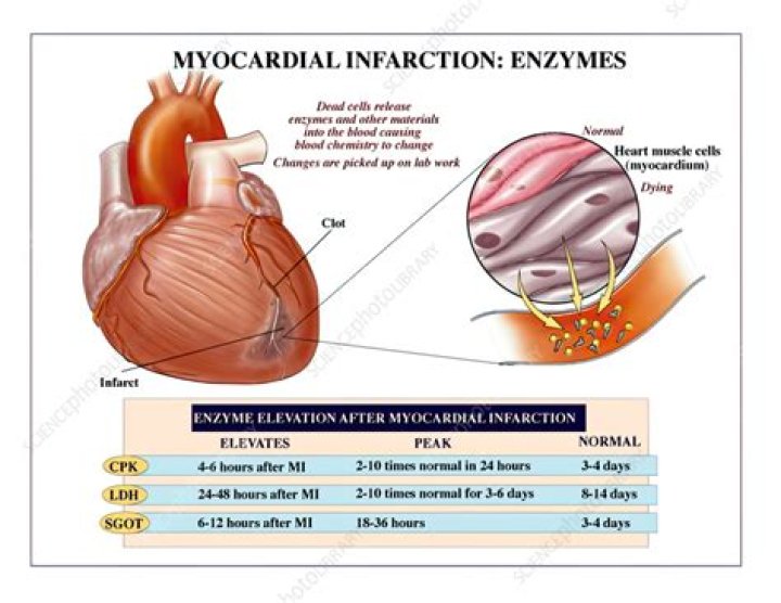 What does it mean when your muscle enzymes are high?