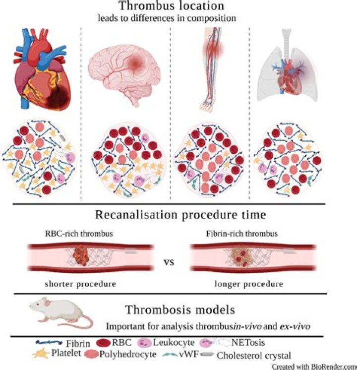 What does thrombotic occlusion mean?