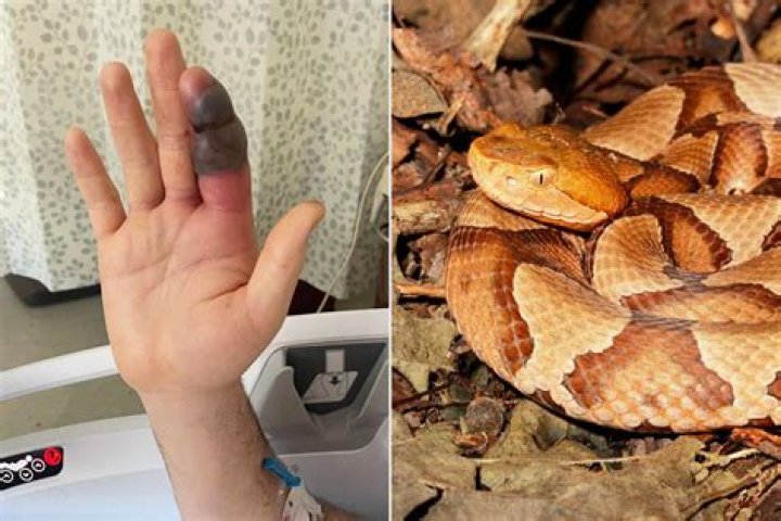 What happens if a copperhead bites a cat?