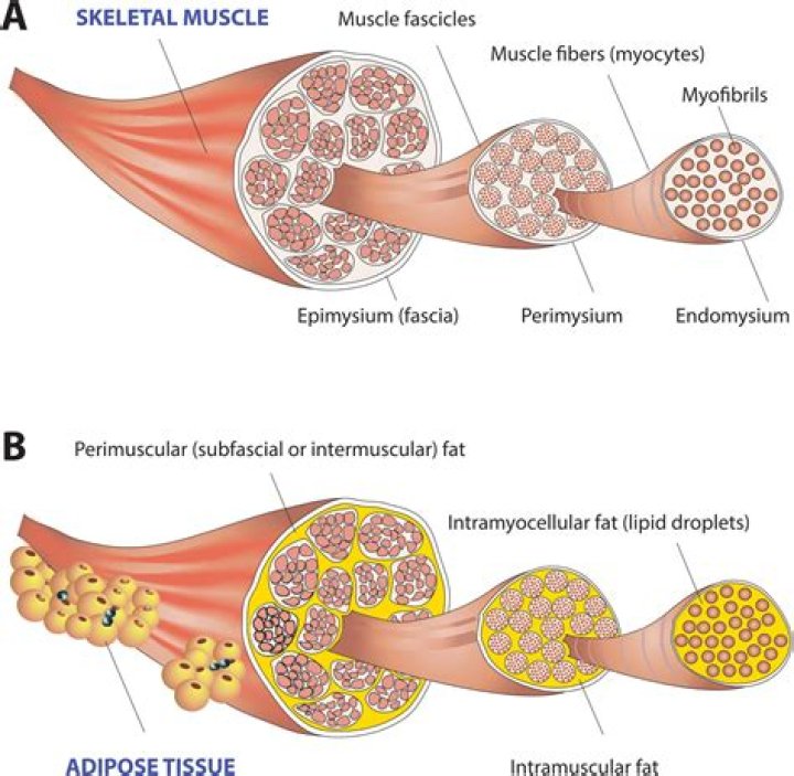 What is Intermuscular adipose tissue?