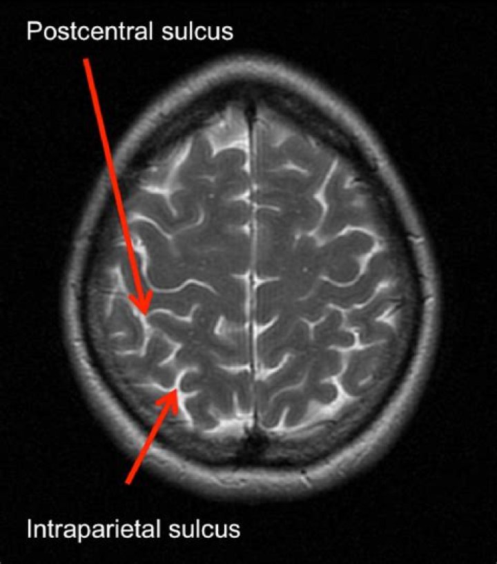 What is prefrontal sulcus?
