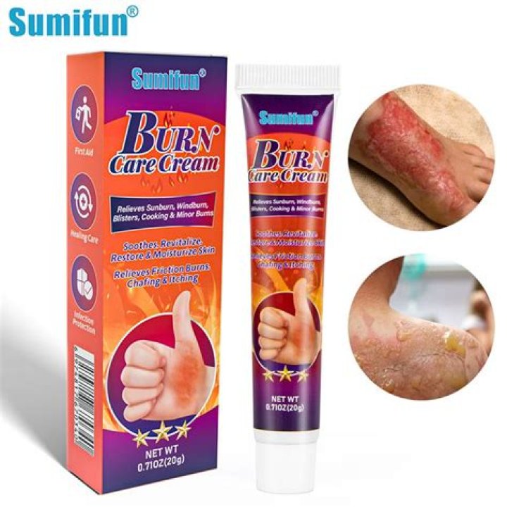 What is the best ointment for sunburn?