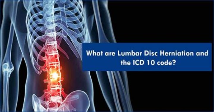 What is the ICD 10 code for lumbar arthritis?