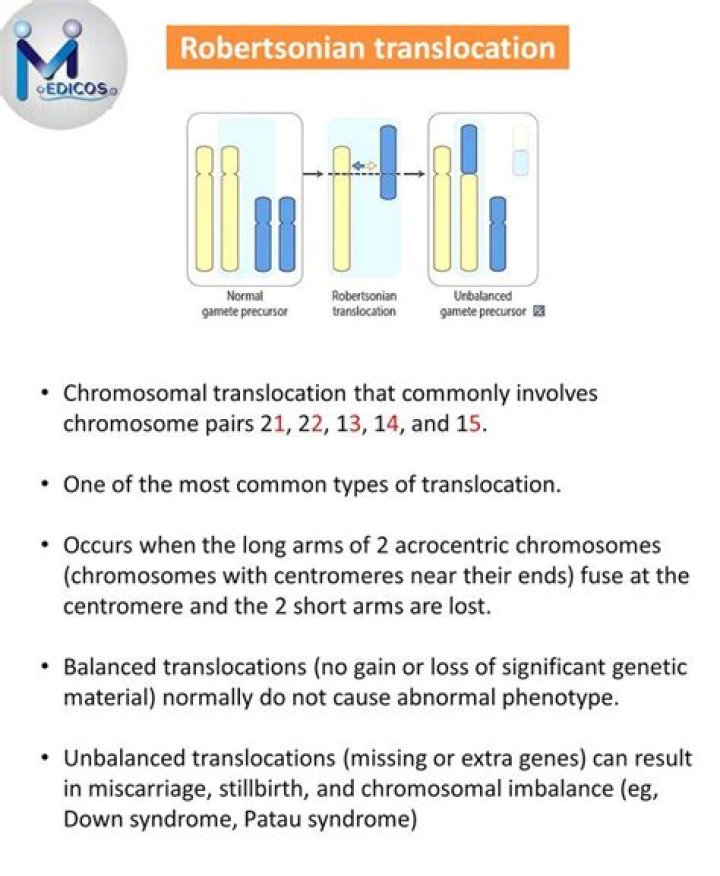What is the most common Robertsonian translocation?