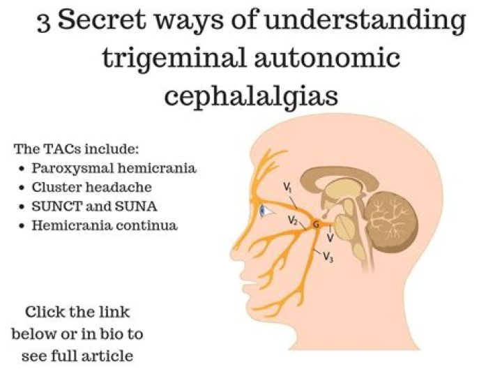 What is trigeminal autonomic Cephalalgias?