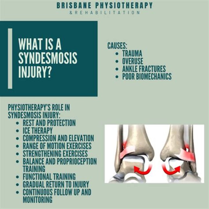 What ligaments are involved in a syndesmosis sprain?