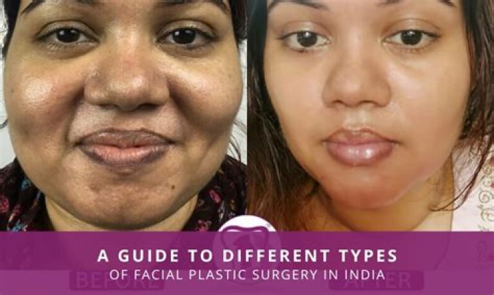 When was the 1st plastic surgery?